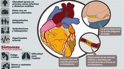 Qué es la dislipidemia cómo se manifiesta y cuál es su tratamiento