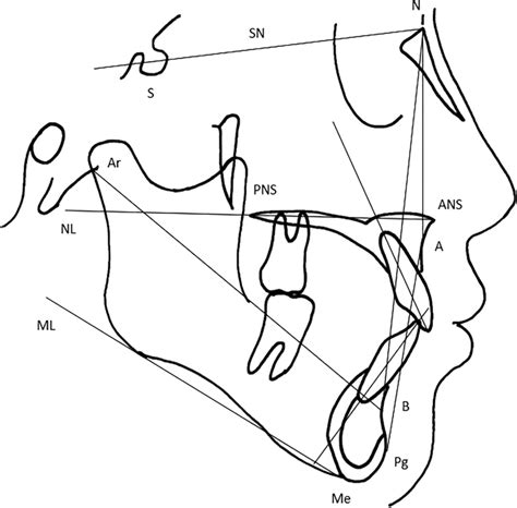 Reference Lines And Points In Lateral Cephalometric Analysis