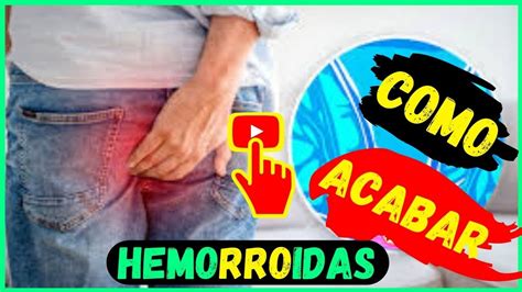 😷 Como Eliminar Hemorroidas Em 30 A 60 Dias Naturalmente Como Tratar