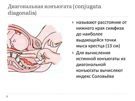 Акушерское исследование (методы обследования беременных и рожениц ...