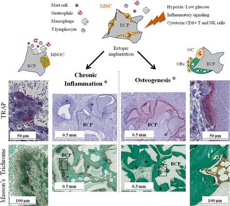 Frontiers Immune Modulation By Transplanted Calcium Phosphate