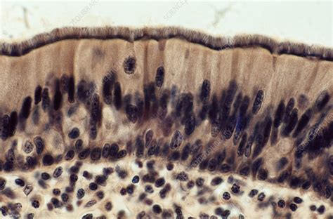 Ciliated Columnar Epithelium Lm Stock Image C0222223 Science