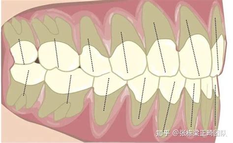 北京牙齿矫正丨为什么没人把牙齿咬合的利害这件事说清楚 知乎