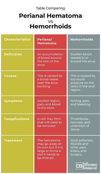 Perbedaan Antara Hematoma Perianal Dan Wasir Diffexpert