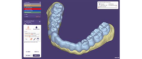 Exocad Dentalcad Elefsina Ultimate Bundle Demo