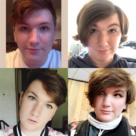 8 Months Hrt Left Is Day 1 Right Is Day 243 R Transtimelines