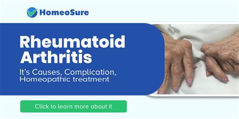 Rheumatoid Arthritis Homeosure