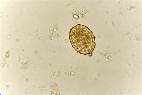 Egg Of Ascaris Lumbricoides In Stool Stock Photo Image Of Cestode