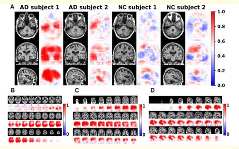 Figure From Development And Validation Of An Interpretable Deep