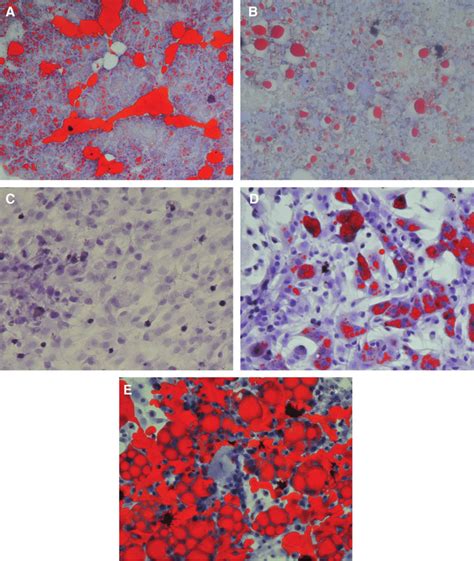 Differentiation Of Adipocytes From Bmscs All Sections Were Stained