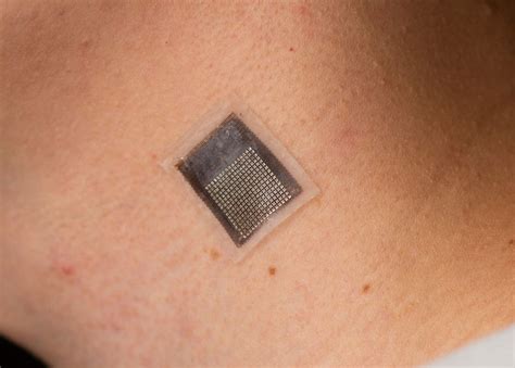 Wearable Ultrasound Patch Provides Deep Tissue Monitoring Lower