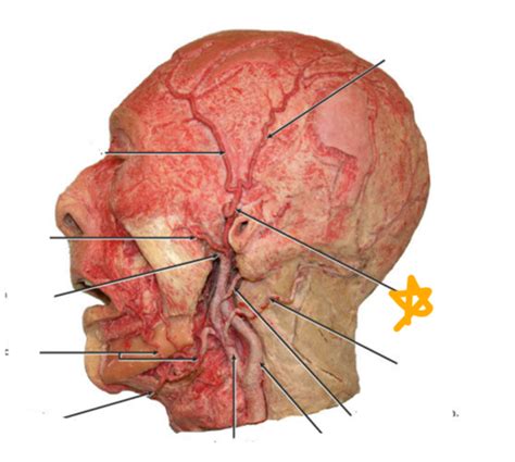 Practical 1 Labs 1 3 Picture Identification Flashcards Quizlet