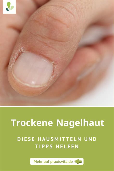 Nagelhaut Trockenheit Trockenenagelhaut Felix Maquillaje Makeup