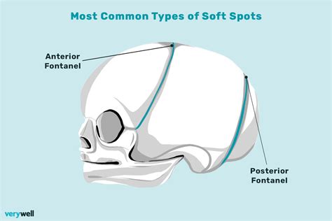 Baby Soft Spot: Anatomy, Function, Conditions