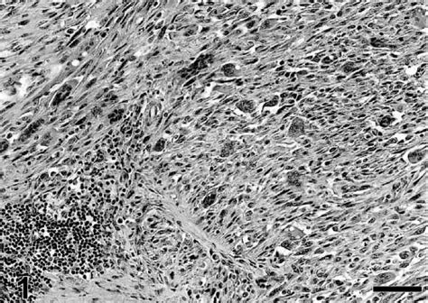 Feline Vaccine Associated Fibrosarcoma Morphologic Distinctions S S Couto S M Griffey P