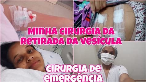 Minha Cirurgia Da Retirada Da Ves Cula Pelo Sus Por V Deo Cirurgia De