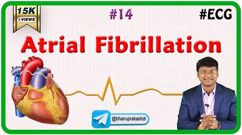 14 Atrial Fibrillation Ecg Assessment And Ecg Interpretation Made Easy Youtube