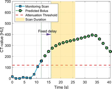 Ct Angiography Of The Aorta Contrast Timing By Using A Fixed Versus A