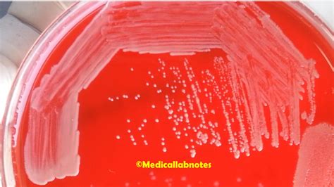 Corynebacterium diphtheriae: Introduction, Morphology, Pathogen