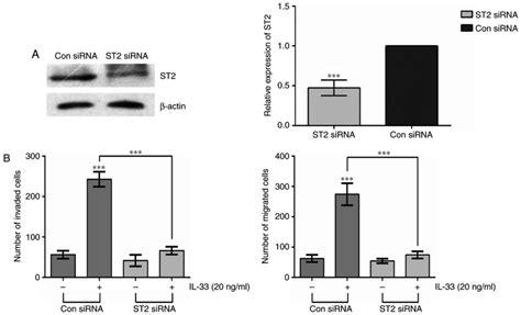 IL33 Enhances Glioma Cell Migration And Invasion By Upregulation Of