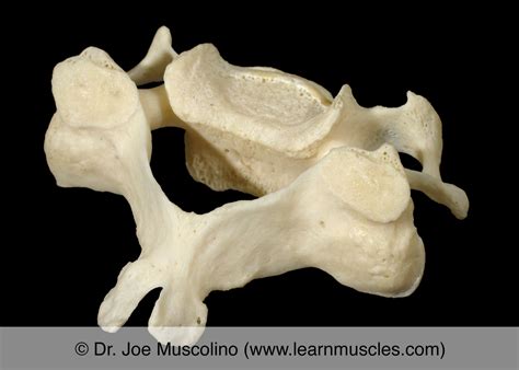 Cervical Vertebrae - Learn Muscles