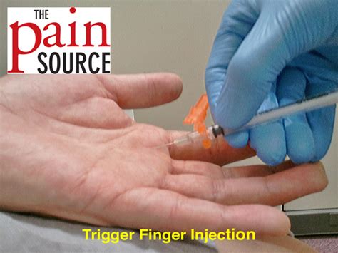 Trigger Finger Injection Technique And Tips The Pain Source Makes