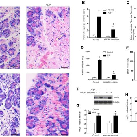 Hmgb1 Inhibition Reduces Acute Pancreatitis Induced Oxidative Stress In