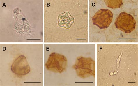 Morphology Of Amoebae A In Vivo Trophozoite With Acanthopodia Of Download Scientific Diagram