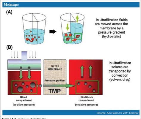 Aquapheresis | Semantic Scholar