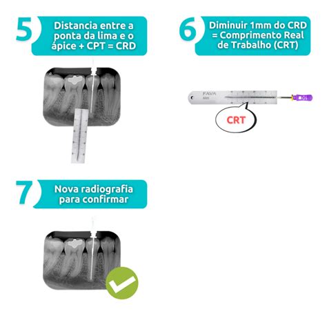 ODONTOMETRIA Resumos Odonto Will