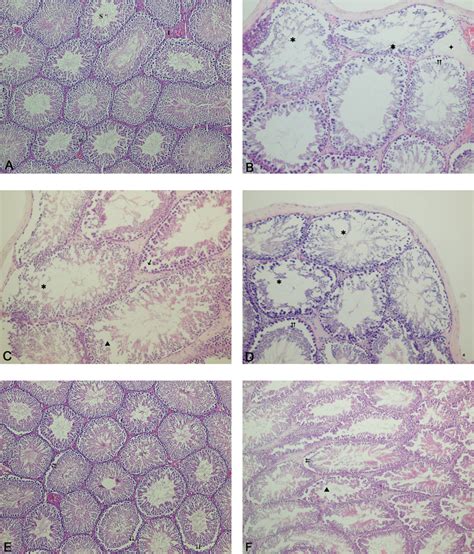 A Testicular Section Of Control Rats Showing Seminiferous Tubules