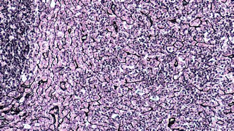 Reticular Connective Tissue Histology