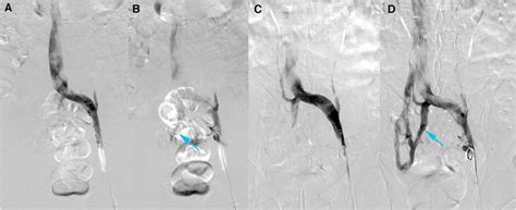 Frontiers Case Report Imaging Features Of A New Type Double Inferior