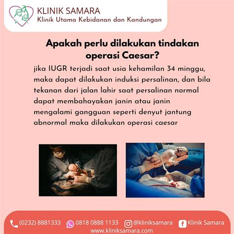 Apa Itu Intrauterine Growth Restriction Iugr Klinik Samara