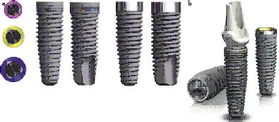 Best Nobel Biocare Implant centre in Chennai ,India