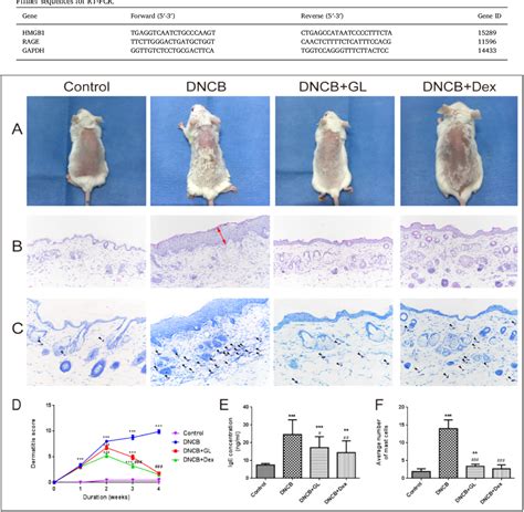 Table 1 From Glycyrrhizin Ameliorates Atopic Dermatitis‐like Symptoms