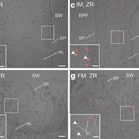 Differential Interference Contrast Dic And Fluorescence Microscopy Of