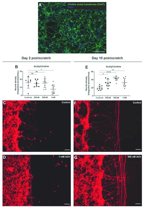 Acetylcholine Shows Biphasic Effect On Neurite Outgrowth In Scratch