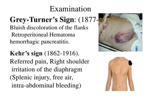 Types Of Abdominal Trauma