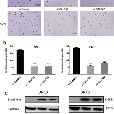 Calr Knockdown Inhibits G1 To S Phase Cell Cycle Transition In Nktcl