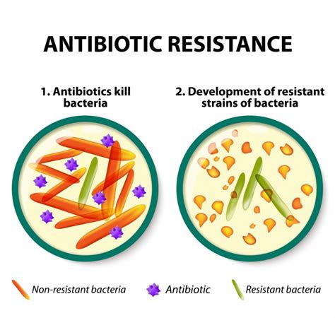 New Model To Aid Antibiotic Resistance Studies • Healthcare In