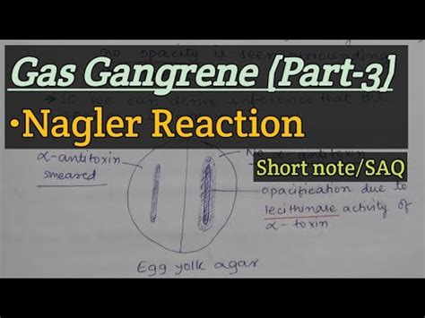 Nagler Reaction Gas Gangrene Part Short Note Saq Youtube