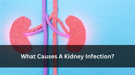 What Causes A Kidney Infection? Uncovering The Culprits