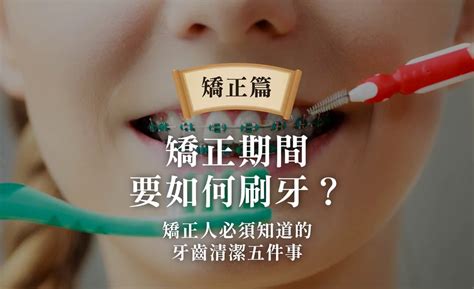 矯正期間要如何刷牙？矯正人必須知道的牙齒清潔五件事！