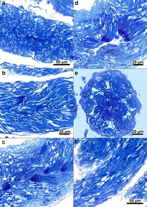 Spermiogenesis In Pharate Adult Drones A And B Testioles Of Early