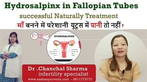 Reyhan Blog Blocked Fallopian Tubes Treatment In Ayurveda