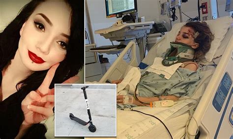 Teenager 18 Faces 150000 Bill Over Brain Injury She Suffered In Us