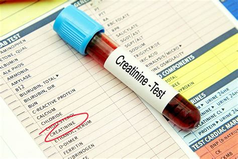 Creatinine and Kidney Function: What You Need to Know - Avoid dialysis ...