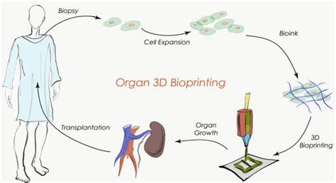 3d Bioprinted Organs Future Of Healthcare Science And Samosa