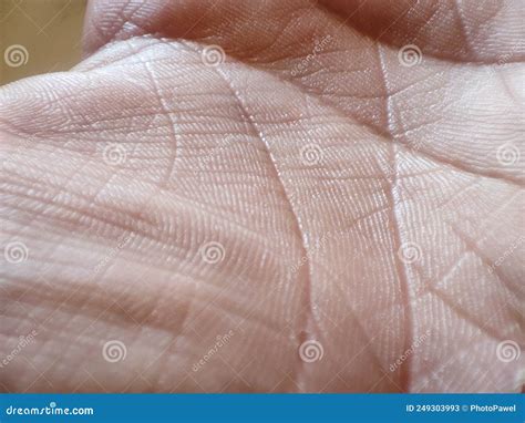 Macro Human Skin Texture Caucasian Healthy Skin Dermatitis Concept